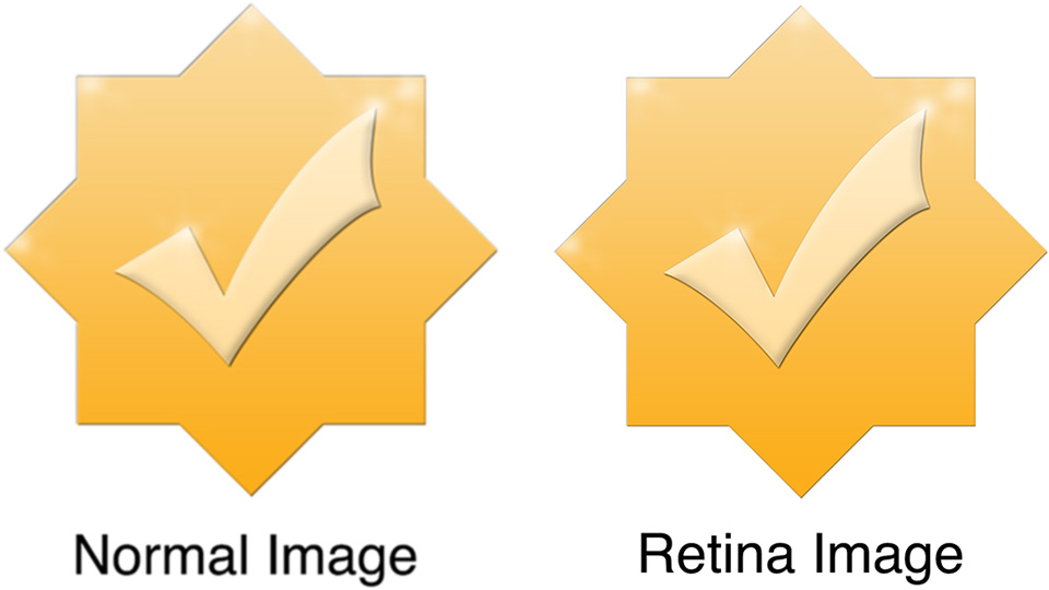 retina image comparison